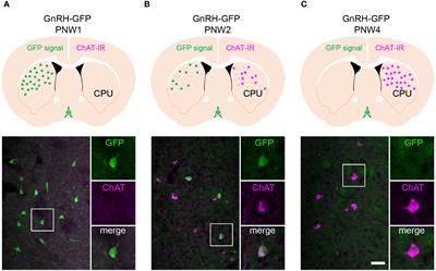 Functional GnRH receptor signaling regulates striatal cholinergic neurons in neonatal but not in adult mice